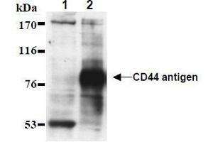 Western Blotting (WB) image for anti-CD44 (CD44) antibody (ABIN1449180) (CD44 antibody)