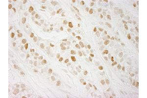 Immunohistochemistry (IHC) image for anti-CTF18, Chromosome Transmission Fidelity Factor 18 Homolog (CHTF18) (AA 25-75) antibody (ABIN7448948)