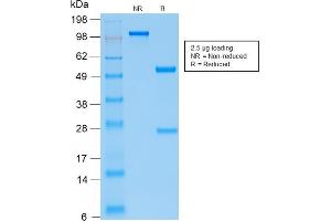 SDS-PAGE Analysis Purified PTH Monospecific Recombinant Rabbit Monoclonal Antibody (PTH/2295R). (Recombinant PTH antibody  (AA 32-115))