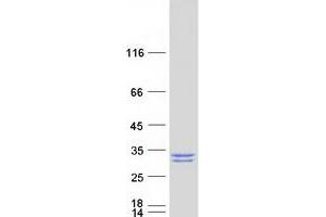 Thioesterase Superfamily Member 5 (THEM5) protein (Myc-DYKDDDDK Tag)