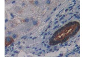 DAB staining on IHC-P; Samples: Human Liver Tissue (LSR antibody  (AA 335-589))