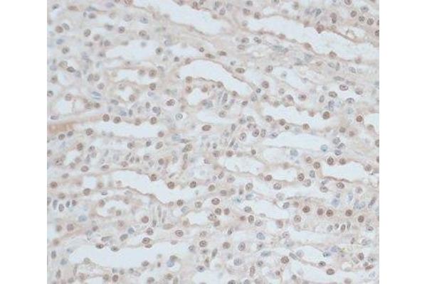 ZNF562 antibody
