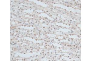 Immunohistochemistry of paraffin-embedded Mouse kidney using ZNF562 Polyclonal Antibody at dilution of 1:100 (40x lens). (ZNF562 antibody)