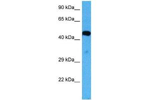 Host:  Mouse  Target Name:  ACVR2B  Sample Tissue:  Mouse Skeletal Muscle  Antibody Dilution:  1ug/ml (ACVR2B antibody  (Middle Region))