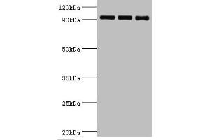 Western blot All lanes: Heat shock protein 105 kDa antibody at 1 μg/mL Lane 1: MCF-7 whole cell lysate Lane 2: Hela whole cell lysate Lane 3: Mouse brain tissue Secondary Goat polyclonal to rabbit IgG at 1/10000 dilution Predicted band size: 97, 93, 98 kDa Observed band size: 97 kDa (HSPH1 antibody  (AA 659-858))