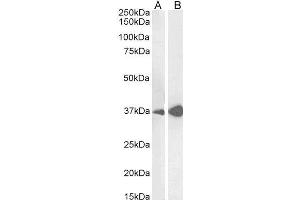 Liver Arginase antibody  (C-Term)