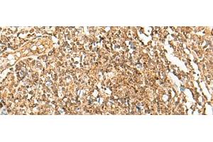 Immunohistochemistry of paraffin-embedded Human tonsil tissue using POLH Polyclonal Antibody at dilution of 1:45(x200) (POLH antibody)