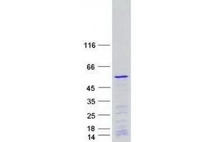 Validation with Western Blot