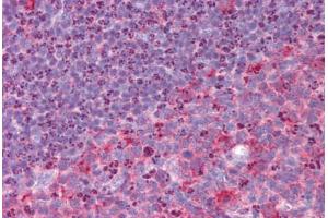 Human Tonsil: Formalin-Fixed, Paraffin-Embedded (FFPE) (RHBDD3 antibody  (Internal Region))