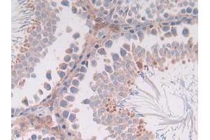 Detection of IL4 in Rat Testis Tissue using Monoclonal Antibody to Interleukin 4 (IL4) (IL-4 antibody  (AA 61-111))