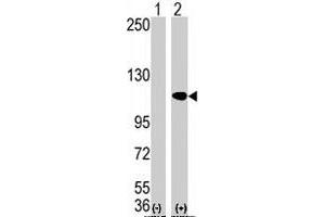 Western blot analysis of AOF2 (arrow) using AOF2 polyclonal antibody . (LSD1 antibody  (N-Term))