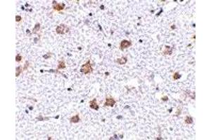 Immunohistochemistry (IHC) image for anti-Mesencephalic Astrocyte-Derived Neurotrophic Factor (MANF) (C-Term) antibody (ABIN1030505)