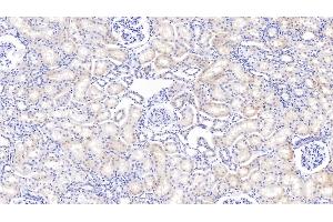 Detection of IGFBP2 in Bovine Kidney Tissue using Polyclonal Antibody to Insulin Like Growth Factor Binding Protein 2 (IGFBP2) (IGFBP2 antibody  (AA 34-317))