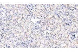 Detection of IGFBP2 in Bovine Kidney Tissue using Polyclonal Antibody to Insulin Like Growth Factor Binding Protein 2 (IGFBP2) (IGFBP2 antibody  (AA 34-317))