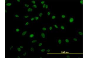 Image no. 4 for anti-Zinc Finger Protein 207 (ZNF207) (AA 1-111) antibody (ABIN599016) (ZNF207 antibody  (AA 1-111))