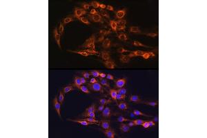 Immunofluorescence analysis of C6 cells using FCGRT Rabbit pAb (ABIN6127922, ABIN6140552, ABIN6140553 and ABIN6224639) at dilution of 1:100 (40x lens). (FcRn antibody  (AA 25-300))