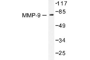 Image no. 1 for anti-Matrix Metallopeptidase 9 (Gelatinase B, 92kDa Gelatinase, 92kDa Type IV Collagenase) (MMP9) antibody (ABIN265534) (MMP 9 antibody)