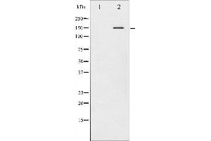 Western blot analysis of Met phosphorylation expression in HepG2 whole cell lysates,The lane on the left is treated with the antigen-specific peptide. (c-MET antibody  (pTyr1349))