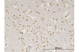 Immunoperoxidase of monoclonal antibody to ZIC4 on formalin-fixed paraffin-embedded human cerebral cortex. (ZIC4 antibody  (AA 1-90))