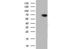 Western Blotting (WB) image for anti-Peroxisomal Biogenesis Factor 5 (PEX5) antibody (ABIN1500157) (PEX5 antibody)