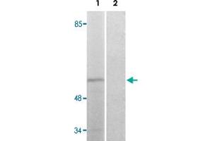 Western blot analysis of Lane 1: COLO205 cells Lane 2: antigen-specific peptide treated COLO205 cells with STK39 (phospho S309) polyclonal antibody . (STK39 antibody  (pSer309))