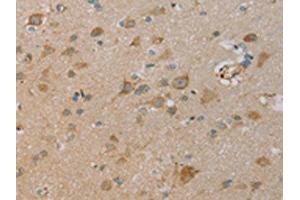 The image on the left is immunohistochemistry of paraffin-embedded Human brain tissue using ABIN7130528(PAGE2 Antibody) at dilution 1/20, on the right is treated with fusion protein. (PAGE2 antibody)