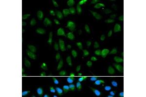 Immunofluorescence analysis of MCF-7 cells using PSMA3 Polyclonal Antibody (PSMA3 antibody)