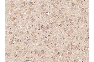 Paraformaldehyde-fixed, paraffin embedded rat brain; Antigen retrieval by boiling in sodium citrate buffer (pH6) for 15min; Block endogenous peroxidase by 3% hydrogen peroxide for 30 minutes; Blocking buffer (normal goat serum) at 37°C for 20min; Antibody incubation with ATF6 Polyclonal Antibody, Unconjugated (bs-23094R) at 1:200 overnight at 4°C, followed by a conjugated secondary and DAB staining. (ATF6 antibody  (AA 431-530))