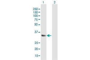 Western Blot analysis of IGFBP5 expression in transfected 293T cell line by IGFBP5 MaxPab polyclonal antibody. (IGFBP5 antibody  (AA 1-272))