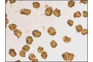 Immunocytochemistry staining of Daudi cells using AP30753PU-N at 2 μg/ml. (SARM1 antibody  (C-Term))