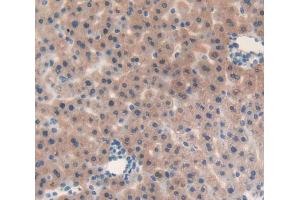 Used in DAB staining on fromalin fixed paraffin- embedded liver tissue (IL-25 antibody  (AA 33-169))