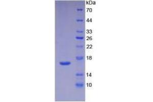 Image no. 3 for Interleukin 16 (IL16) (AA 1203-1332) (Active) protein (His tag) (ABIN6239762) (IL16 Protein (AA 1203-1332) (His tag))