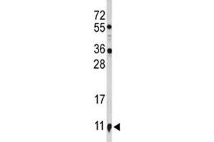 Western blot analysis of S100A10 antibody and NCI-H460 lysate. (S100A10 antibody  (AA 12-40))