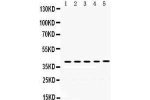 Western Blotting (WB) image for anti-Oncostatin M (OSM) (AA 26-220) antibody (ABIN3043458) (Oncostatin M antibody  (AA 26-220))