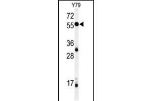 Western blot analysis of NOB1 Antibody in Y79 cell line lysates (35ug/lane)