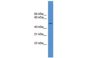 WB Suggested Anti-IL7R Antibody Titration: 0. (IL7R antibody  (Middle Region))
