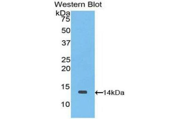CCL9 Antikörper  (AA 27-117)