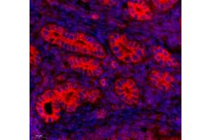 Immunofluorescence of paraffin embedded mouse uterus using Tuba3a (ABIN7076051) at dilution of 1: 600 (450x lens) (Tuba3a antibody)