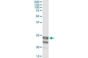 Immunoprecipitation of NAAA transfected lysate using anti-NAAA monoclonal antibody and Protein A Magnetic Bead , and immunoblotted with NAAA MaxPab rabbit polyclonal antibody. (NAAA antibody  (AA 36-104))