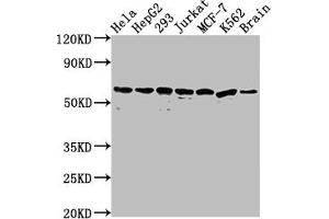 Western Blot Positive WB detected in: Hela whole cell lysate, HepG2 whole cell lysate, 293 whole cell lysate, Jurkat whole cell lysate, MCF-7 whole cell lysate, K562 whole cell lysate, Mouse brain tissue All lanes: HSPD1 antibody at 1:2000 Secondary Goat polyclonal to rabbit IgG at 1/50000 dilution Predicted band size: 62, 18 kDa Observed band size: 60 kDa (Recombinant HSPD1 antibody)
