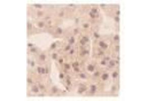 Image no. 1 for anti-Chemokine (C-X-C Motif) Ligand 10 (CXCL10) antibody (ABIN791563) (CXCL10 antibody)