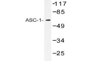 Western blot (WB) analysis of ASC-1 antibody in extracts from K562 cells. (TRIP4 antibody)