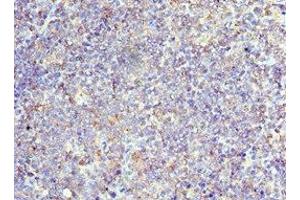 Immunohistochemistry of paraffin-embedded human tonsil tissue using ABIN7171339 at dilution of 1:100 (CD6 antibody  (AA 424-668))