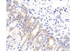 Immunohistochemistry analysis of paraffin-embedded mouse stomach using Catenin beta Monoclonal Antibody at dilution of 1:200. (beta Catenin antibody)