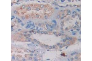 IHC-P analysis of Human Tissue, with DAB staining. (Riboflavin Kinase antibody  (AA 1-155))