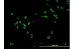 Immunofluorescence of monoclonal antibody to RCC1 on HeLa cell. (RCC1 antibody  (AA 312-421))