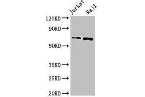Western Blot Positive WB detected in: Jurkat whole cell lysate, Raji whole cell lysate All lanes: CDC6 antibody at 2. (CDC6 antibody  (AA 1-141))