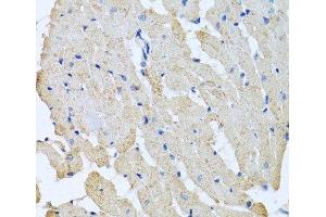 Immunohistochemistry of paraffin-embedded Rat heart using GPLD1 Polyclonal Antibody at dilution of 1:100 (40x lens).