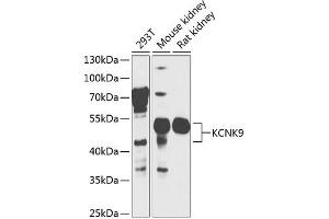 Western blot analysis of extracts of various cell lines, using KCNK9 antibody  at 1:1000 dilution. (KCNK9 antibody  (AA 1-100))