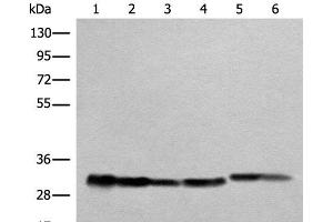 Western blot analysis of Human heart tissue A549 231 Jurkat HEPG2 and Hela cell lysates using ATP5C1 Polyclonal Antibody at dilution of 1:1000 (ATP5C1 antibody)